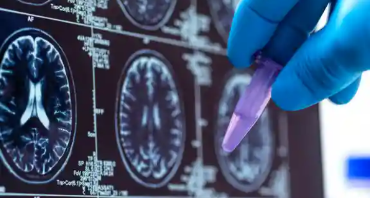 EE.UU. vigila posible brote de peste pulmonar en Rusia